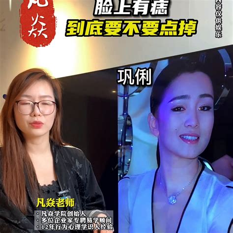 臉部有痣|脸上的痣到底要不要祛除？听听专家怎么说